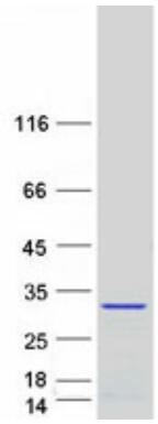 Coomassie blue staining of purified TNNI3 protein.